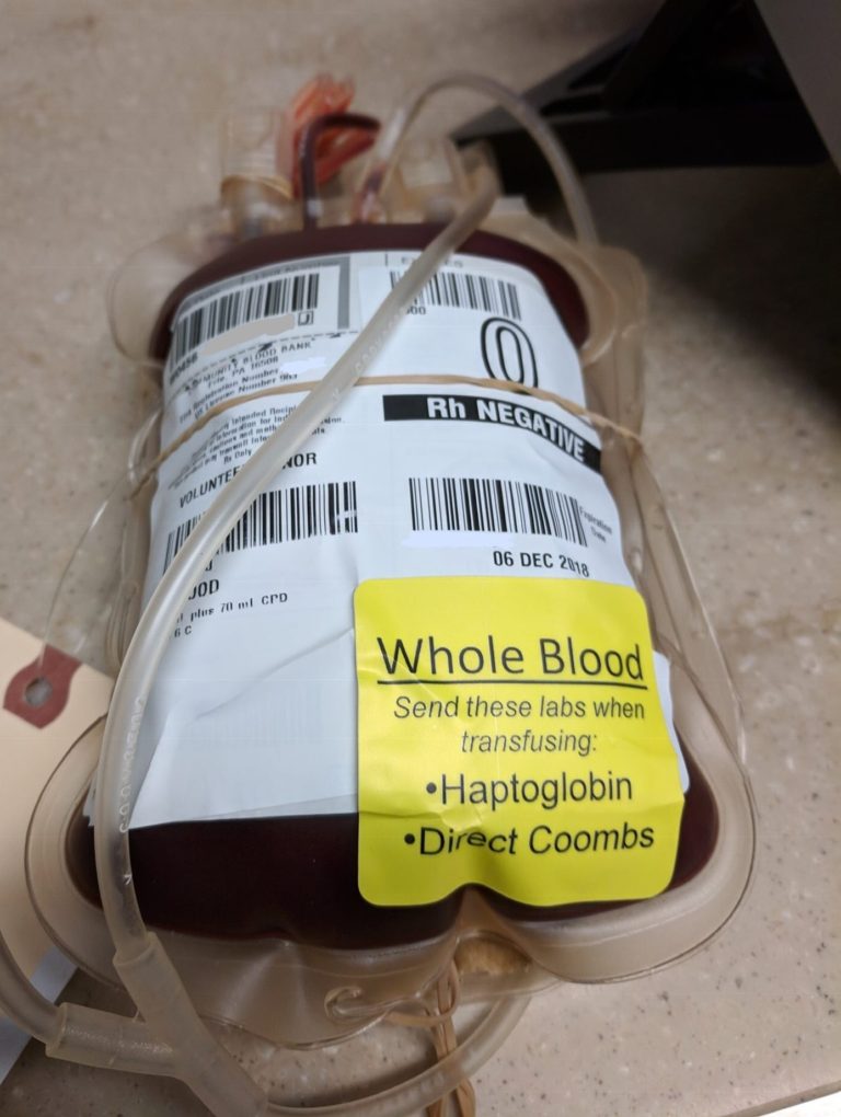 Setting up a whole blood program? 5 questions you need to answer ...